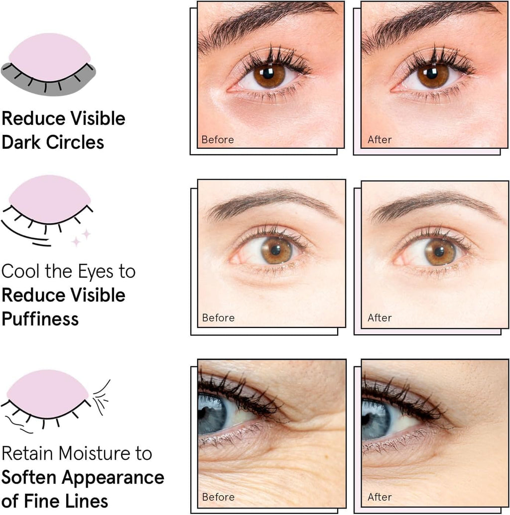 Collagen Under Eye Masks